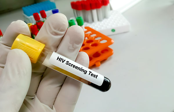 HIV Care | Dr AM Gaffoor